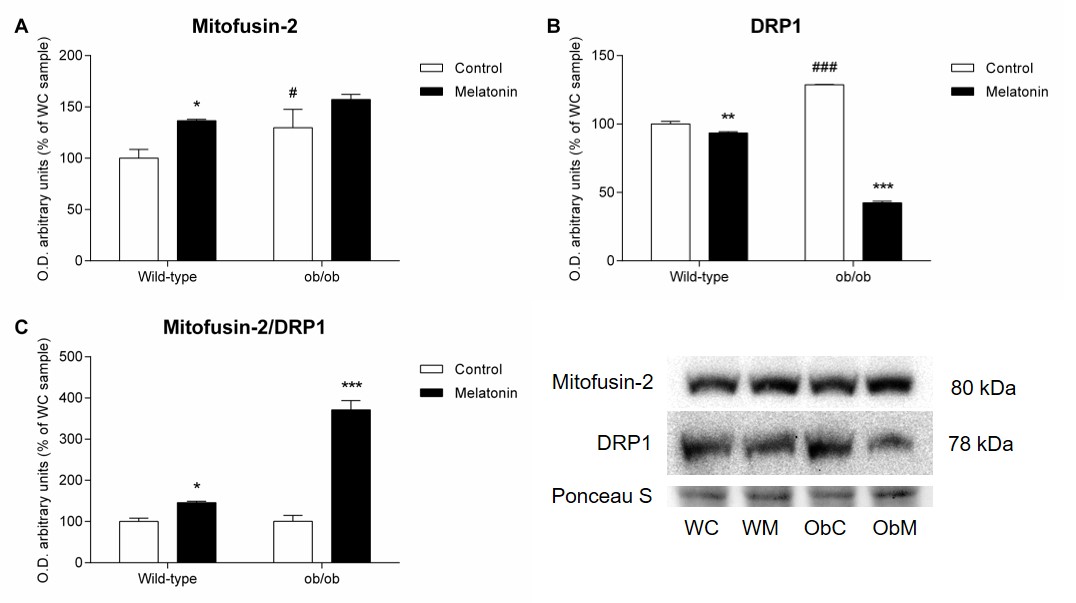 Pleiotropic Role Of Melatonin In Brain Mitochondria Of Obese Mice Melatonin Research